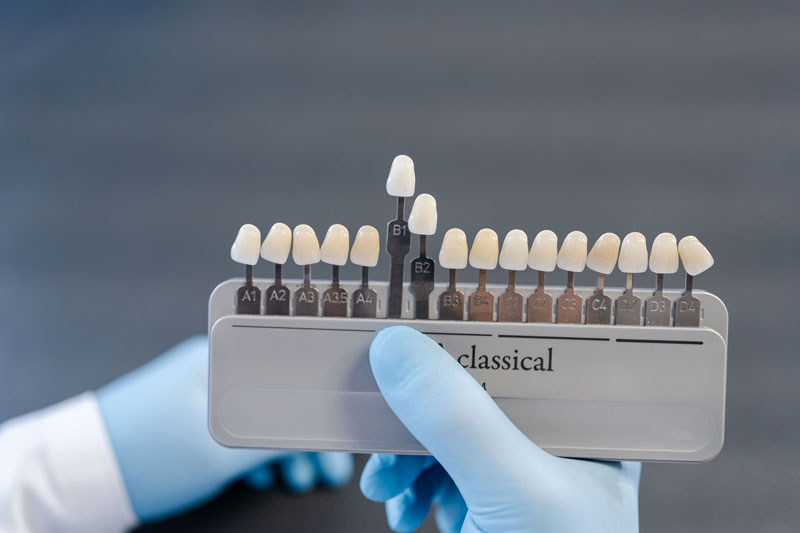 Dental technician holding a palette of tooth shade samples to match the color of dental implants or restorations, ensuring a natural and precise fit.